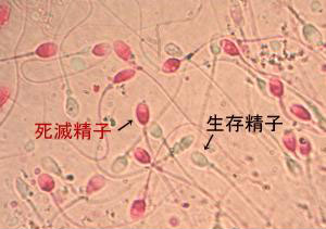 精子生存率